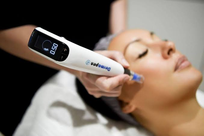 Collagen Induction Therapy_img_3